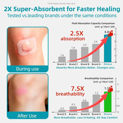 Grade Hydrocolloid Acne Patch, Acne spot treatment
