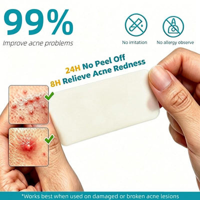 Grade Hydrocolloid Acne Patch, Acne spot treatment