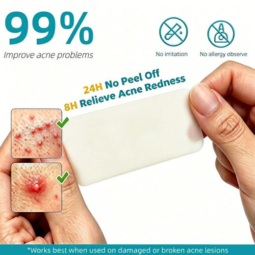 Wileva™ ClearSkin Hydrocolloid Roll. Cover More. Wake Up Clearer.